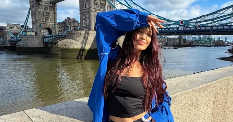 Alina Eremia, cu fața umflată pe Instagram: reacție alergică „agresivă” și matinalul ProFM ratat