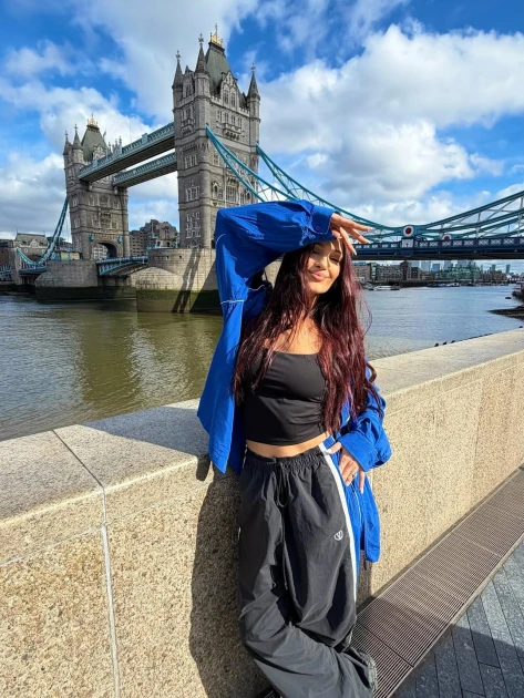 Alina Eremia, cu fața umflată pe Instagram: reacție alergică „agresivă” și matinalul ProFM ratat