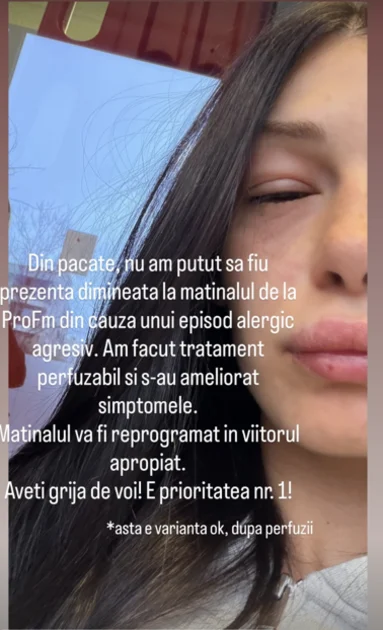 Alina Eremia, cu fața umflată pe Instagram: reacție alergică „agresivă” și matinalul ProFM ratat