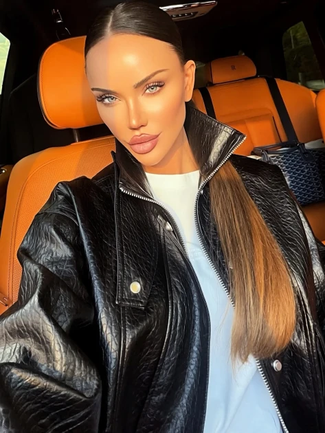 Bianca Drăgușanu anunță a treia rinoplastie: ce spune despre primele două intervenții